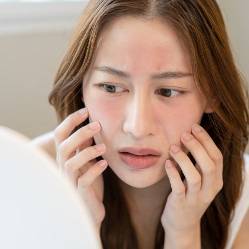 Anti-aging serums suitable for sensitive or reactive skin. - Mirasoa Cares