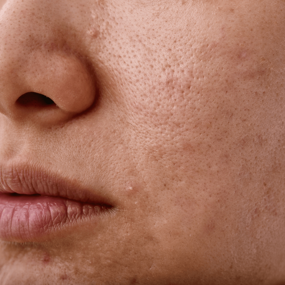 Keep Your Face Away from Bacteria - Mirasoa Cares