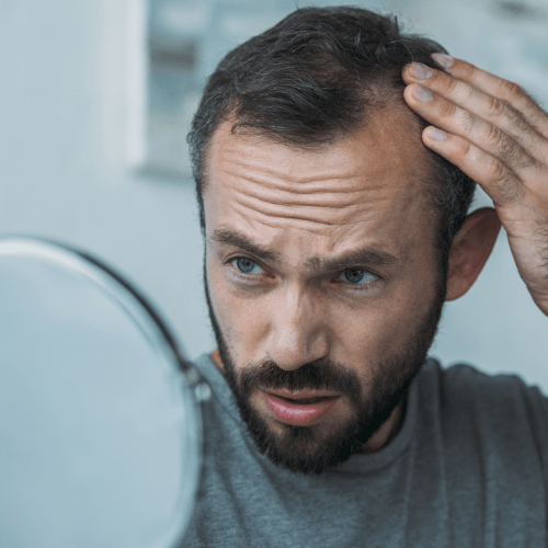 The most common causes of hair loss and how anti-hair loss serums can help - Mirasoa Cares