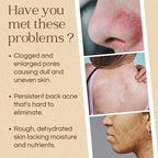 Gurkmeja & Tea Tree - tvål - Mirasoa Cares